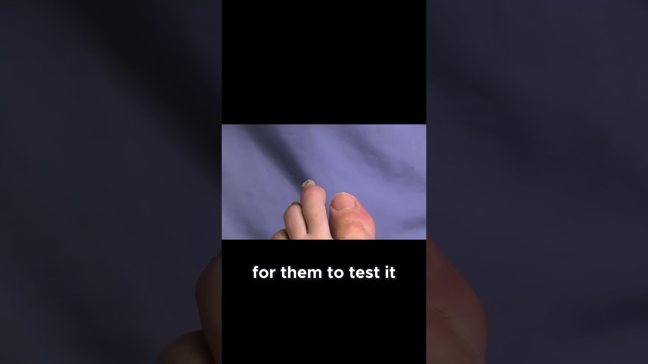 How to Properly Trim Thick Nails! #NailCare #HealthyFeet #TrimmingTips 1