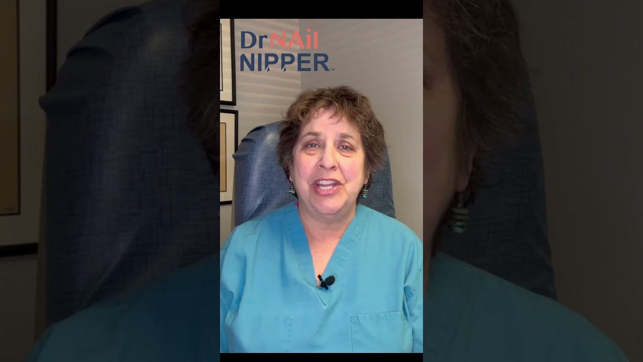 Toenails and very cold weather - Intro #nordic #Norway 1