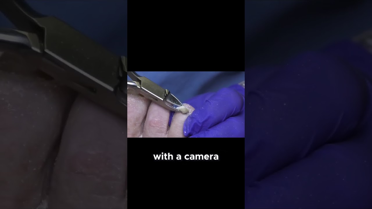 Advanced Vascular Treatments A Game Changer #MedicalInnovation #VascularHealth #ModernMedicine 1