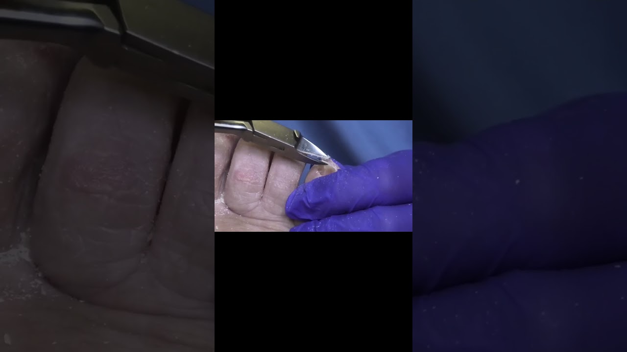 Podiatry Humor Lightening the Mood 1