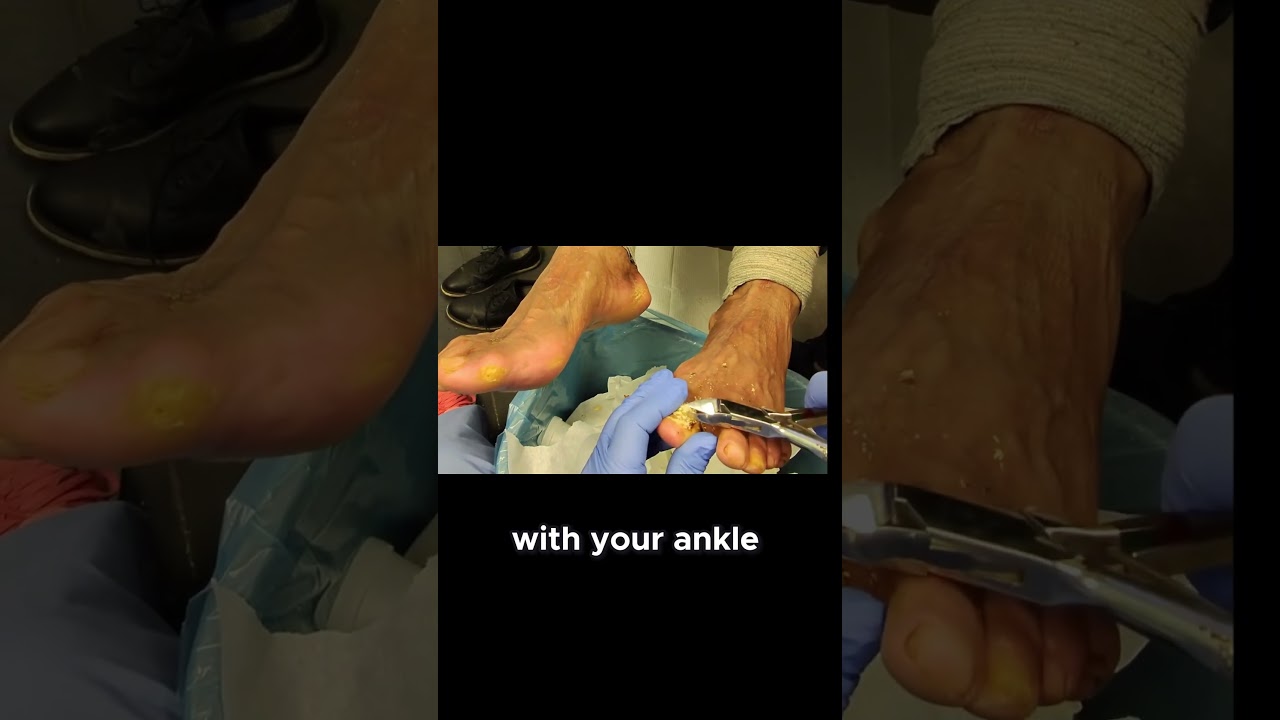 Nail Care Removing the Unattached Parts 1