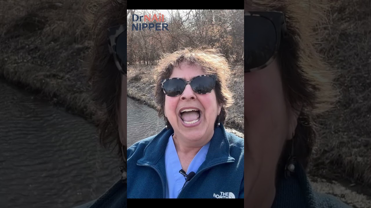 YAY Callus Day - Intro #drnailnipper #callustoday #callustreatment 1