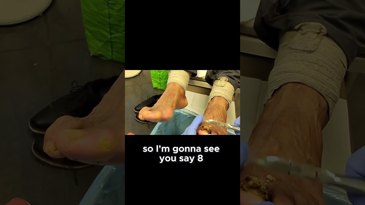 Getting Ready for the Shower: Flip Flops Needed #flipflops #foothealth #shower 1