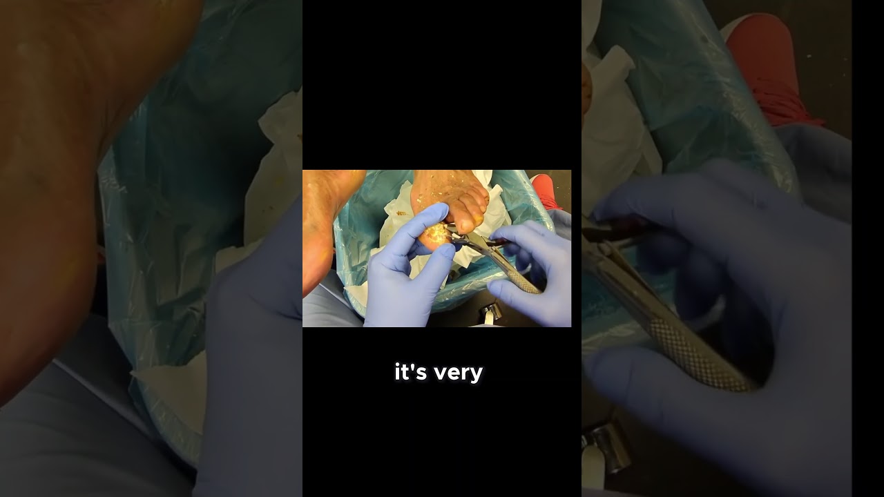 Spring is Here Enjoy the Daylight! #springtime #daylight #seasonchange 1