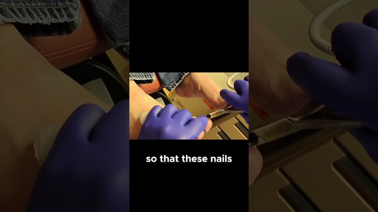 Medicare Benefits for Diabetic Foot Care 1