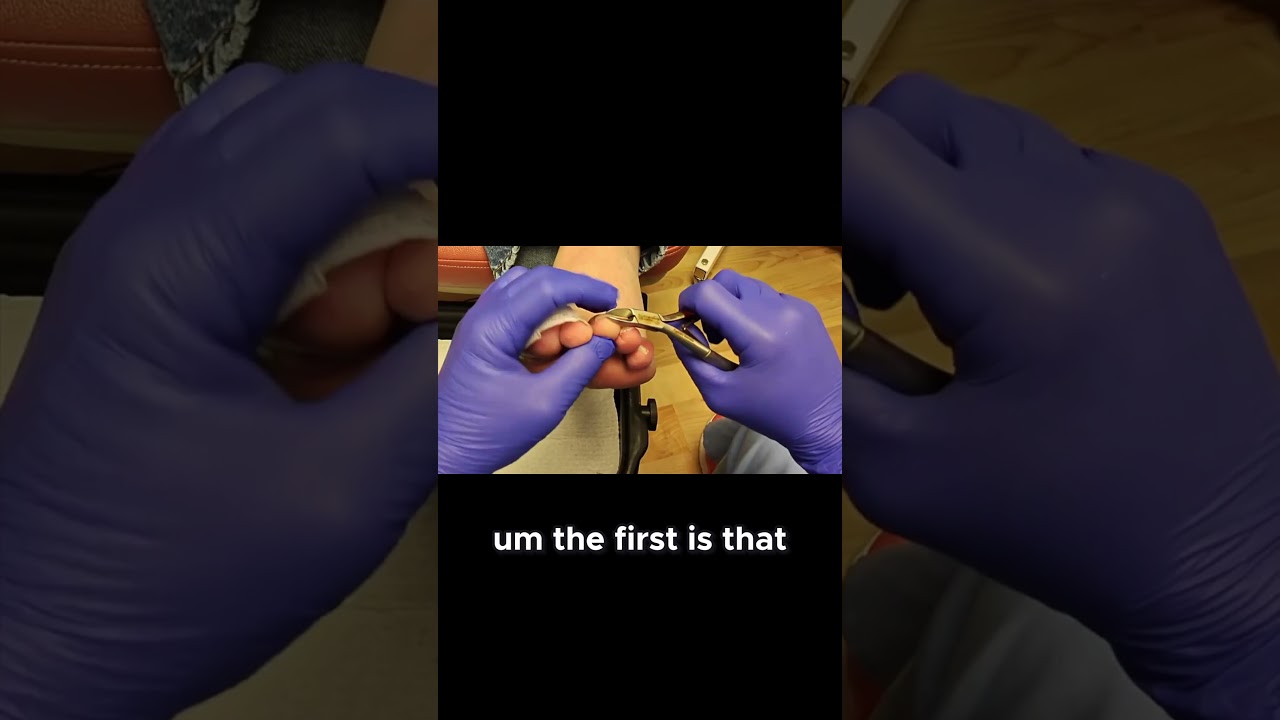 Diabetic Neuropathy Essential Foot Care Tips #DiabeticCare #FootHealth #healthtips 1