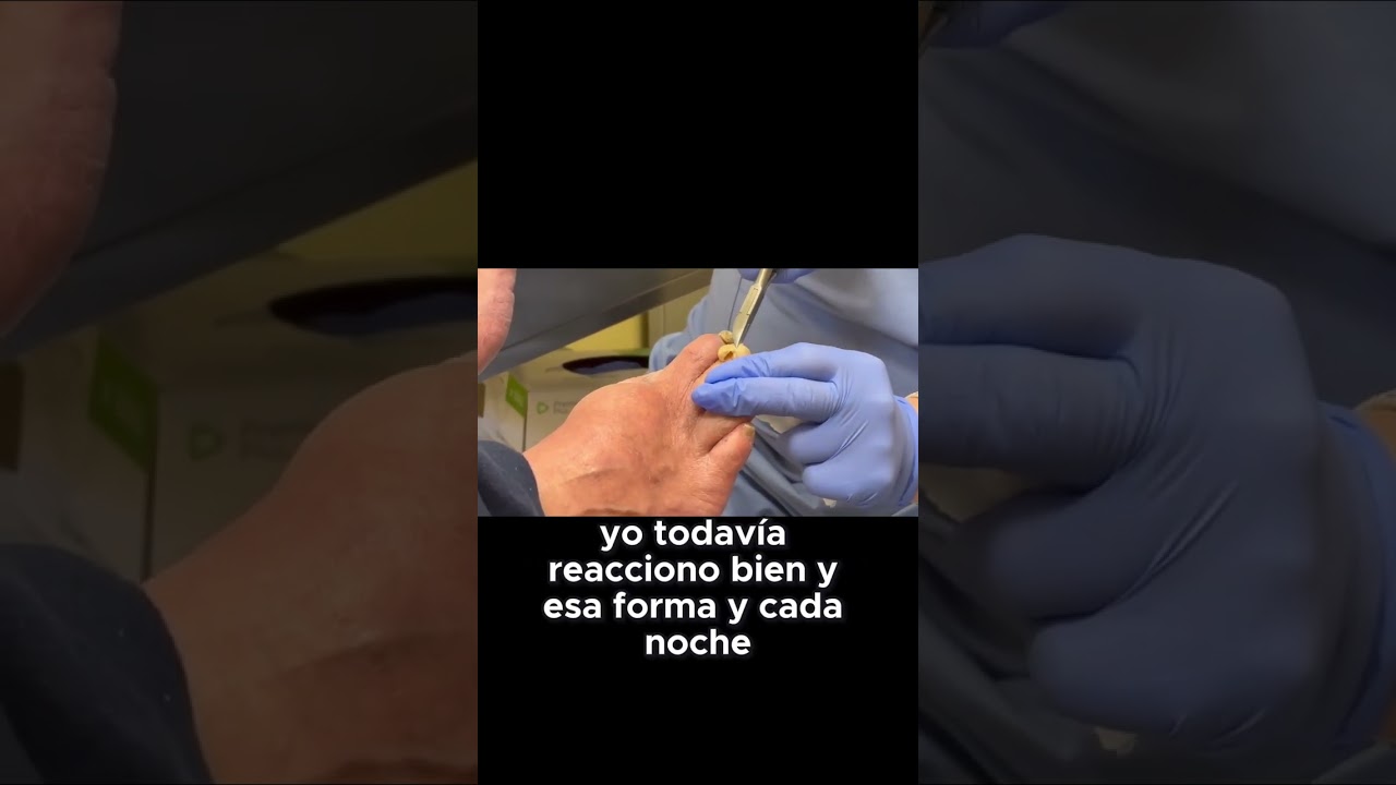 Consejos para cuidar tus pies diabéticos #Diabetes #CuidadoDePies #Salud #Prevención 1