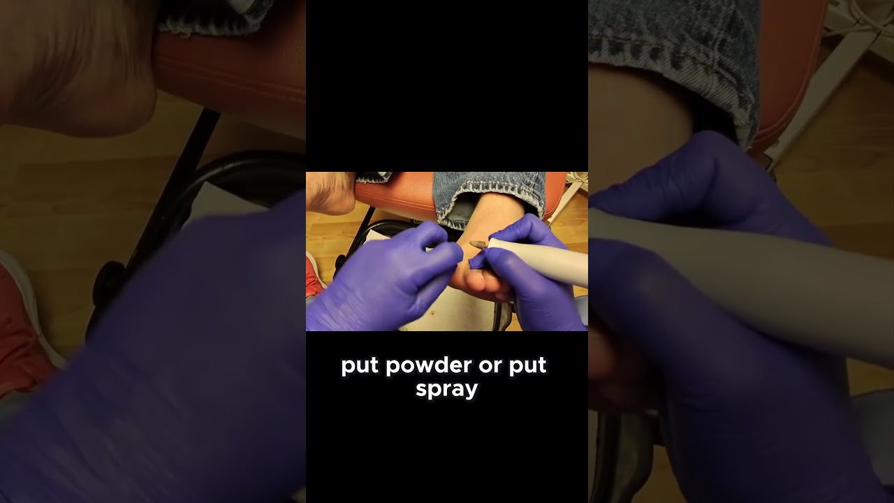 Foot Spray Tips for Diabetics! 1