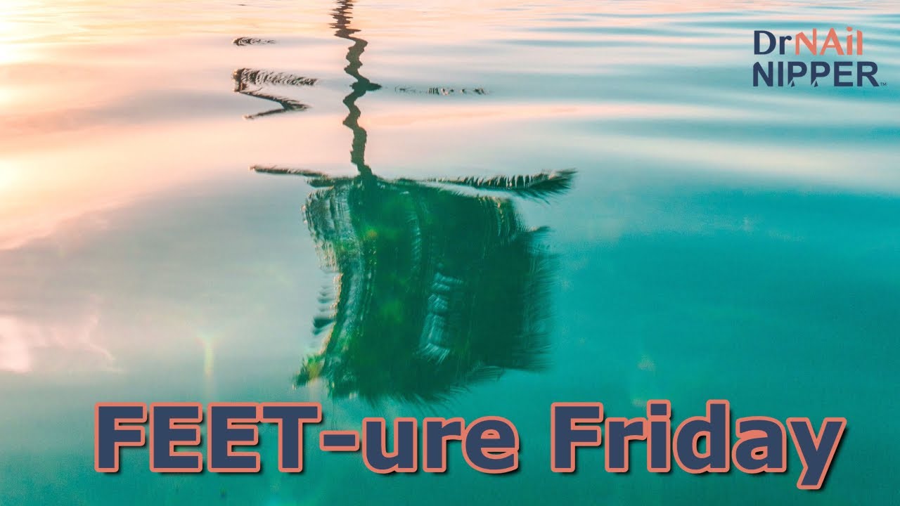 FEET-ure Friday | She Has Gout, But Not in Her Foot 1