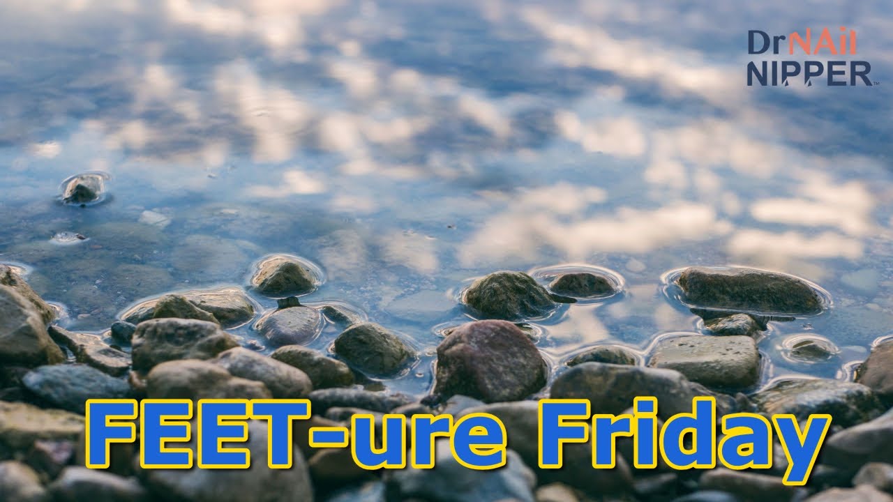 FEET-ure Friday | Fungal Toenails and Severe Athlete's Foot #fungalinfections #athletesfoot 1