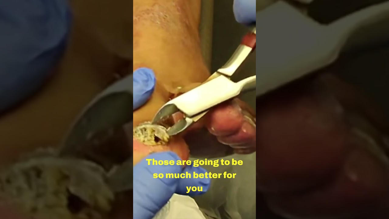 Trimming Time: A Talk on Nail Health 💅✨ 1