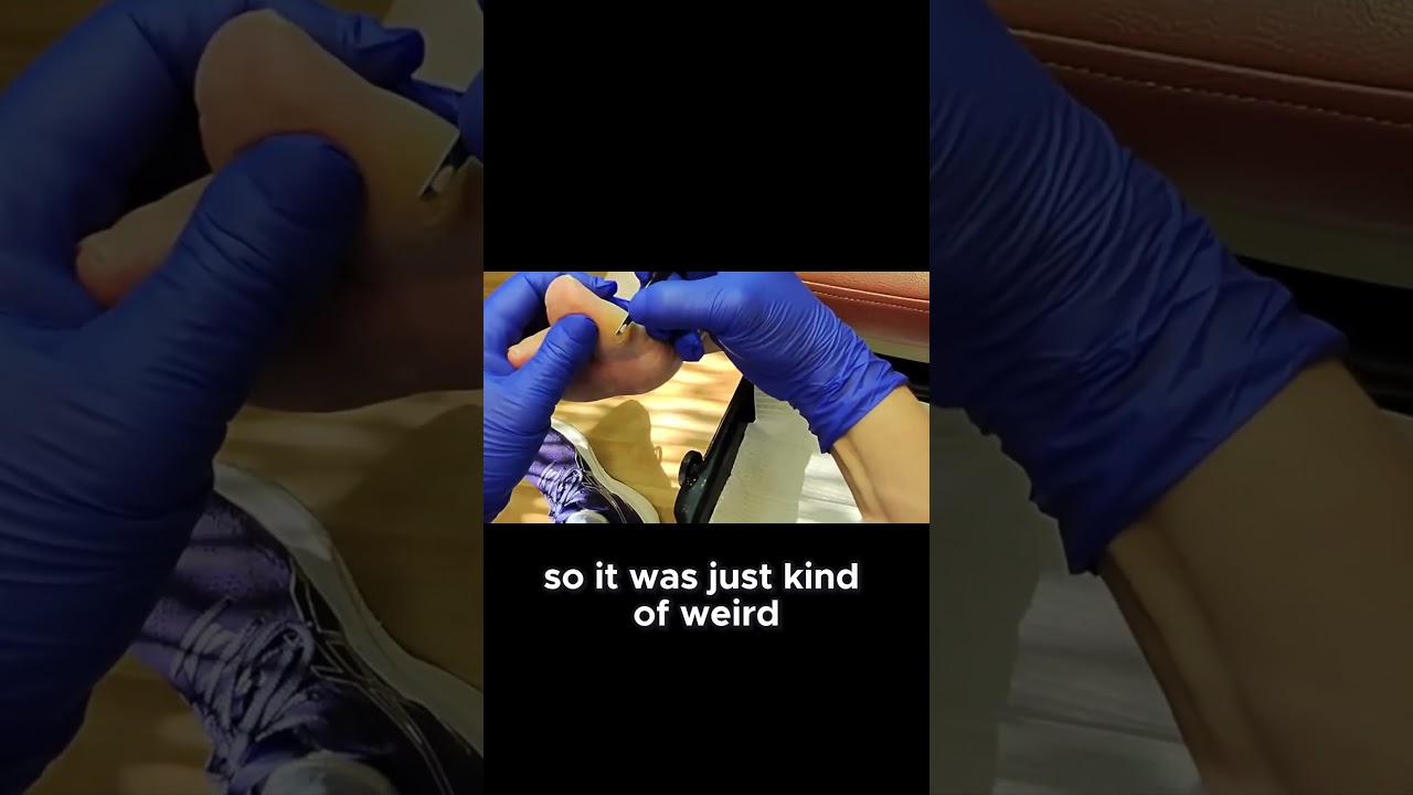 The Mystery of the Farmer Who Didn't Want His Cows Photographed! #drnailnipper #foothealth 2