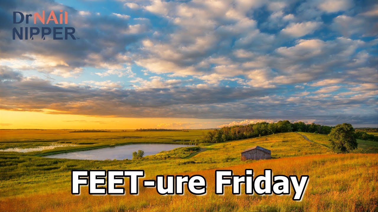 FEET-ure Friday | One Single Keratotic Horn 4